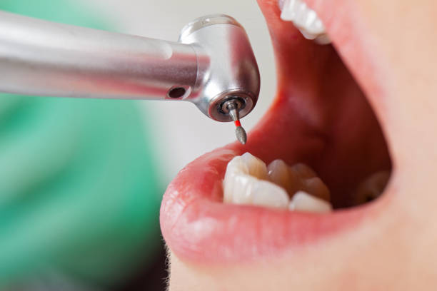 Best Emergency Treatment for Toothache in St Albans, WV